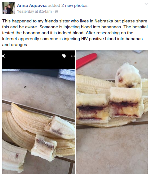 Hiv Banane