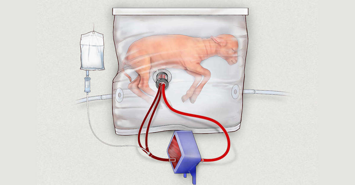 Illustration of premature lamb in artificial womb