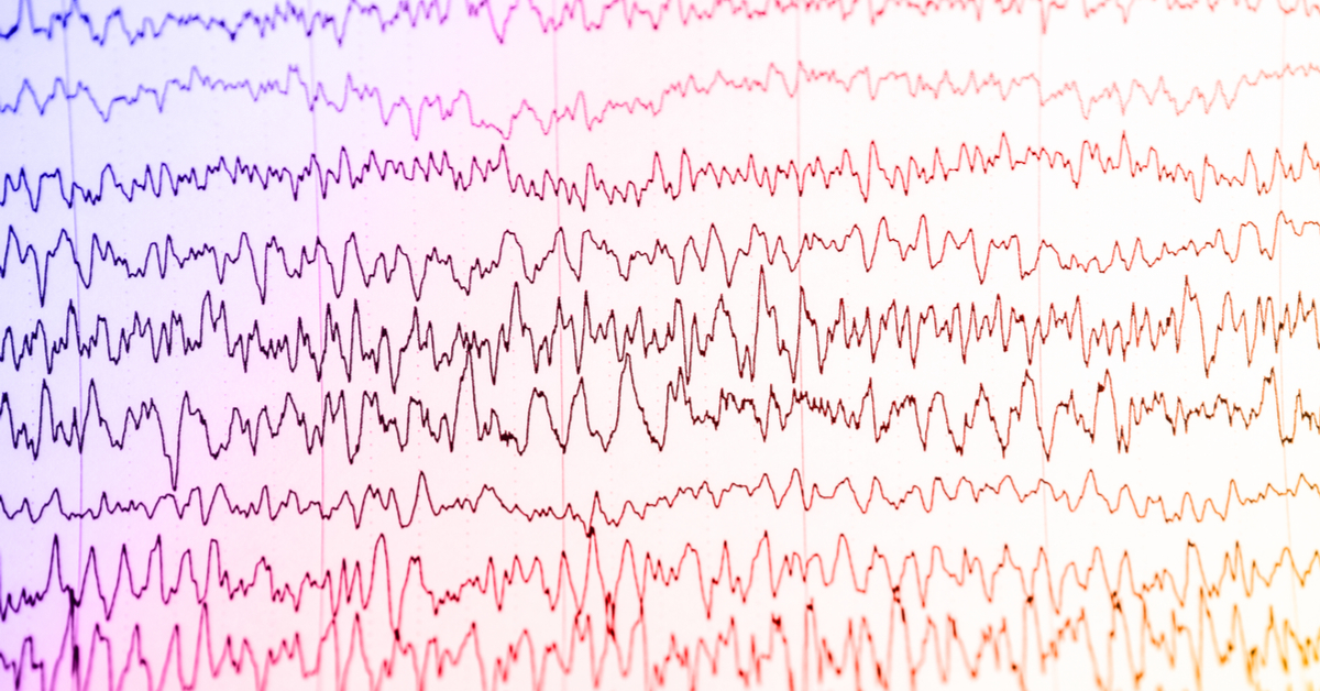 Abnormal EEG results.