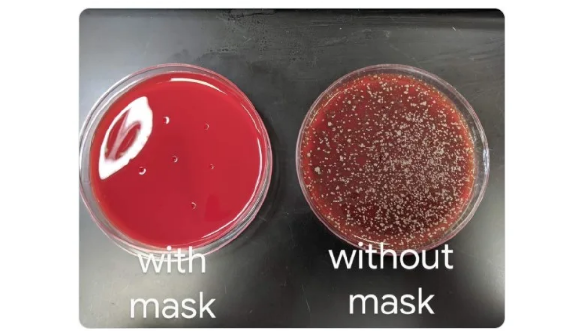 Are These Petri Dishes Coughed On With and Without a Mask?