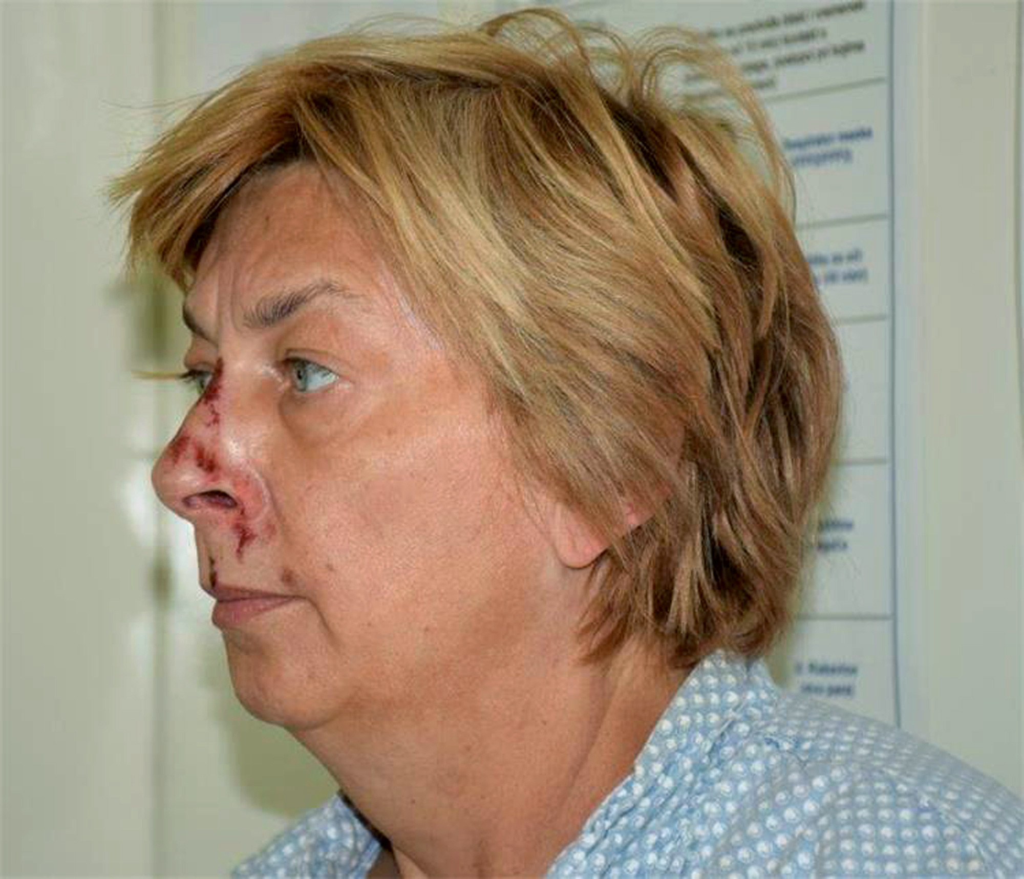 This undated photo provided by the Croatian Police shows an unidentified woman who was found on the Adriatic island of Krk on Sept. 12, 2021. Croatian police said Tuesday, Sept. 21, 2021 they are still working to establish the identity of a woman found over a week ago at a northern Adriatic Sea island with no recollection of who she is or where she came from. Police told the Associated Press they are searching the terrain and conducting numerous interviews with residents and tourists or anyone who has information about the woman discovered on the island of Krk on Sept. 12. (Croatian Police via AP)