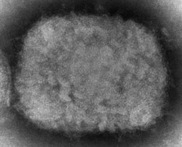 This 2003 electron microscope image made available by the Centers for Disease Control and Prevention shows a monkeypox virion, obtained from a sample associated with the 2003 prairie dog outbreak. On Wednesday, May 18, 2022, Massachusetts has reported a rare case of monkeypox in a man who recently had traveled to Canada, and investigators are looking into whether it is connected to recent cases in Europe. (Cynthia S. Goldsmith, Russell Regner/CDC via AP)