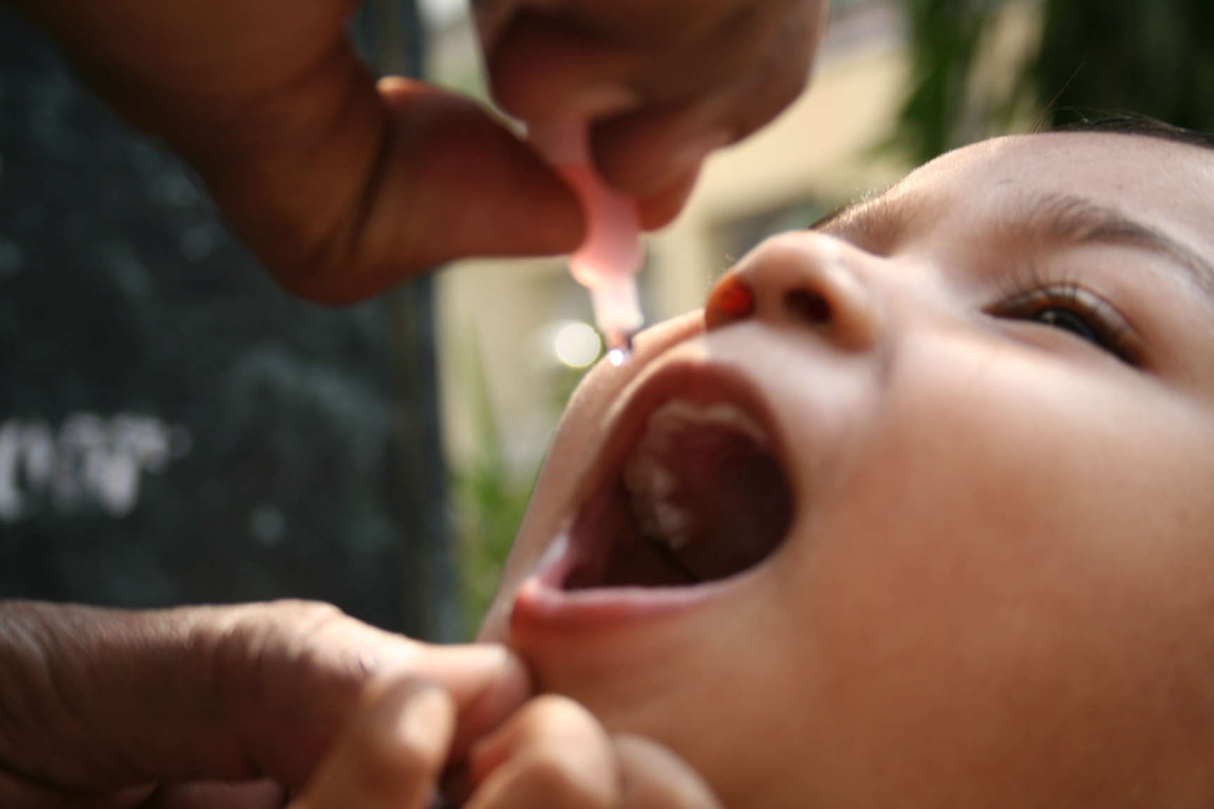 Oral polio vaccine can cause vaccine-derived poliovirus infection