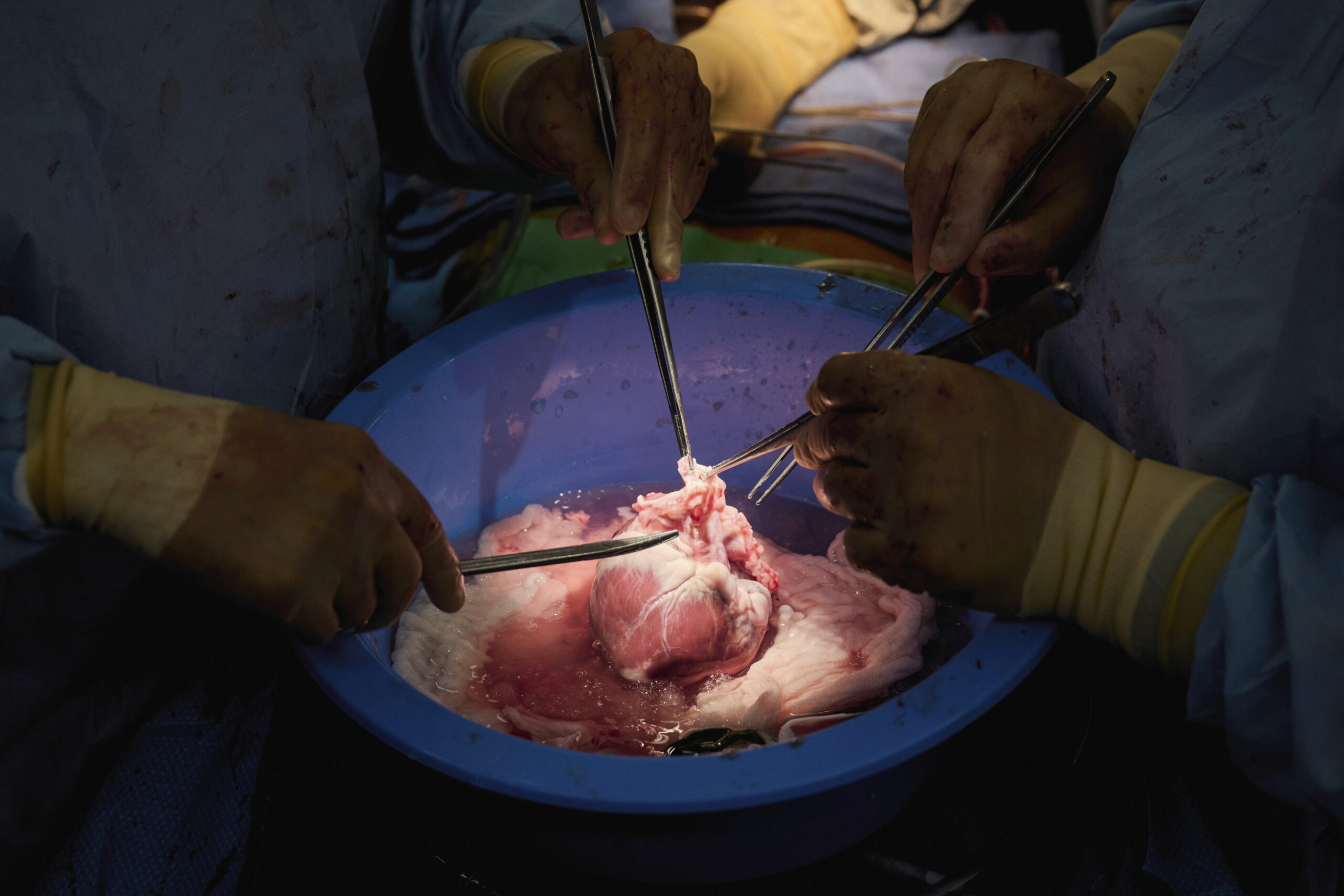 Pig Organ Transplants Inch Closer with Testing in the Dead